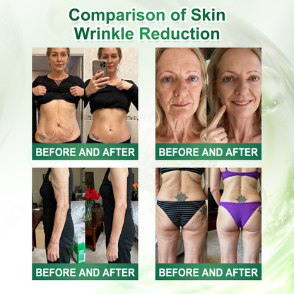 🔥 New! | Curalona® Lymphatic Detox: 10-in-1 Sculpting Serum. Eliminates toxins, burns stubborn fat, smooths wrinkles, and supports joint health. (1 daily application: feel your body lighter and your skin detoxified in just 7 days).