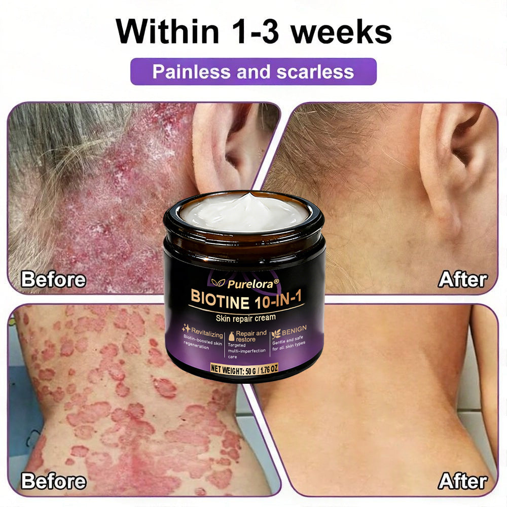 Made and shipped from Australia 🍁 Purelora® Biotin 10-in-1 Skin Repair Cream — Last day of the sale: 25% off.