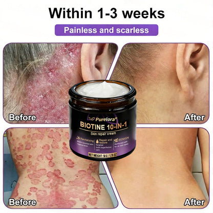 Made and shipped from Australia 🍁 Purelora® Biotin 10-in-1 Skin Repair Cream — Last day of the sale: 25% off.