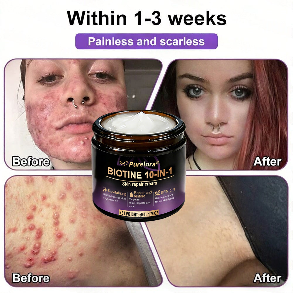 Made and shipped from Australia 🍁 Purelora® Biotin 10-in-1 Skin Repair Cream — Last day of the sale: 25% off.