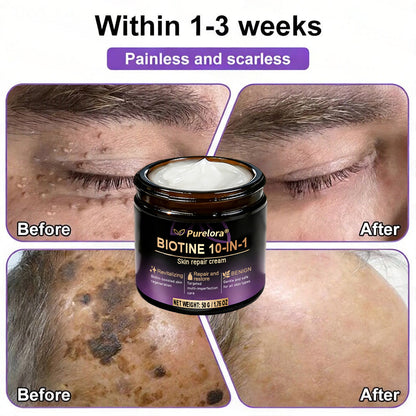 Made and shipped from Australia 🍁 Purelora® Biotin 10-in-1 Skin Repair Cream — Last day of the sale: 25% off.