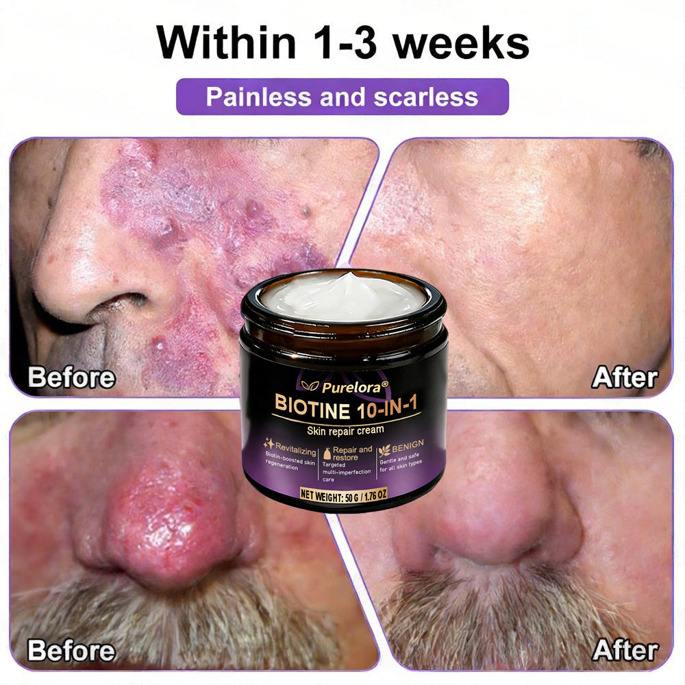 Made and shipped from Australia 🍁 Purelora® Biotin 10-in-1 Skin Repair Cream — Last day of the sale: 25% off.