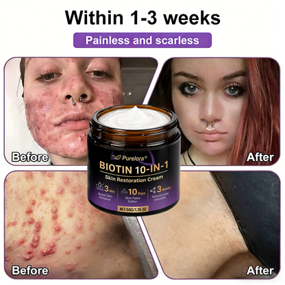 Made and shipped from Australia 🍁 Purelora® Biotin 10-in-1 Skin Repair Cream — Last day of the sale: 25% off.