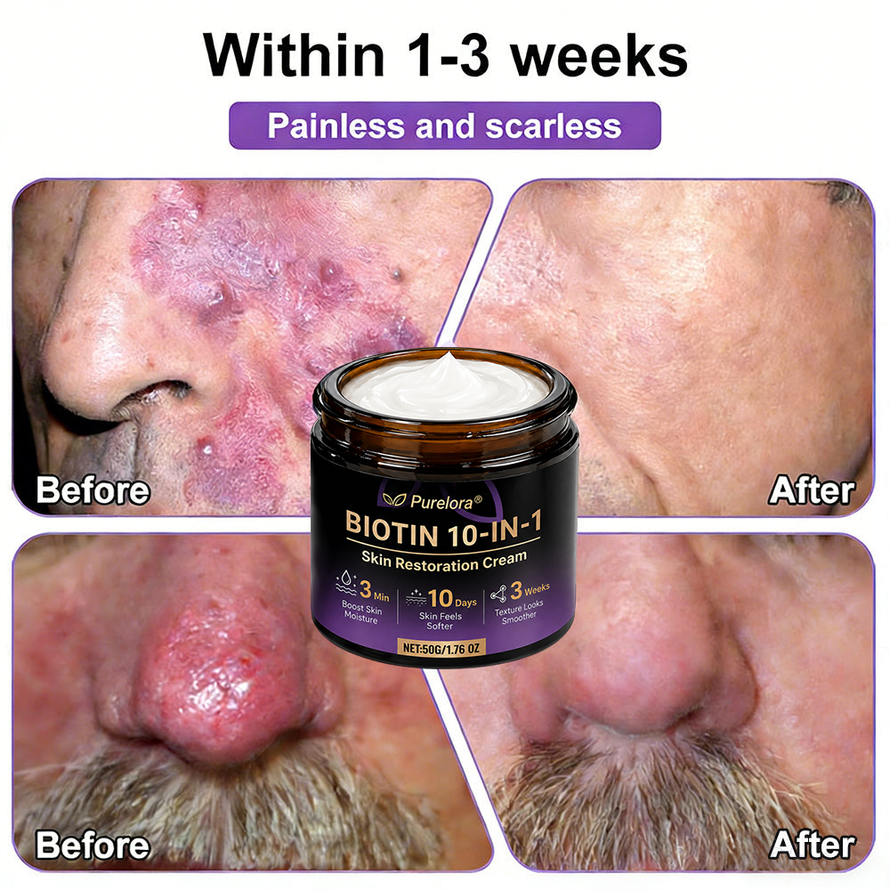Made and shipped from Australia 🍁 Purelora® Biotin 10-in-1 Skin Repair Cream — Last day of the sale: 25% off.